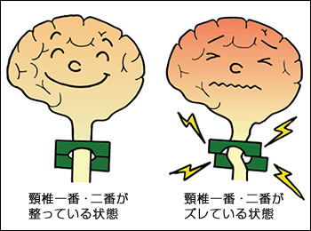 脳の状態イメージ